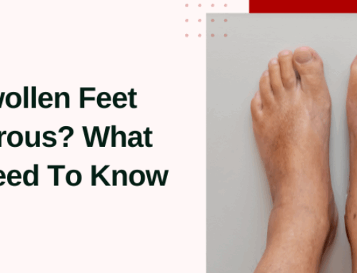 Are Swollen Feet Dangerous? What You Need To Know