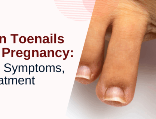 Ingrown Toenails During Pregnancy: Causes, Symptoms, and Treatment