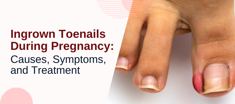 Ingrown-Toenails-During-Pregnancy-Causes-Symptoms-and-Treatment