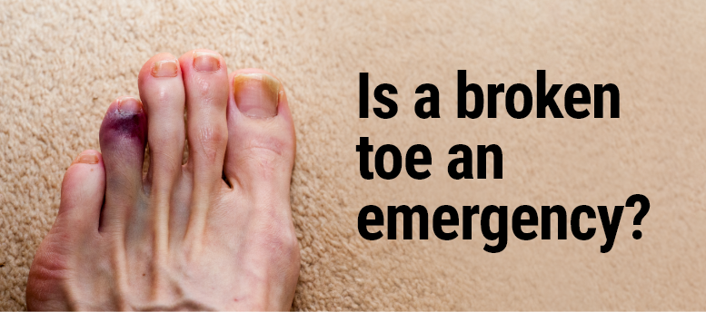 Is-a-broken-toe-an-emergency-–-3