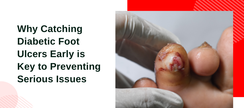 Why-Catching-Diabetic-Foot-Ulcers-Early-is-Key-to-Preventing-Serious-Issues