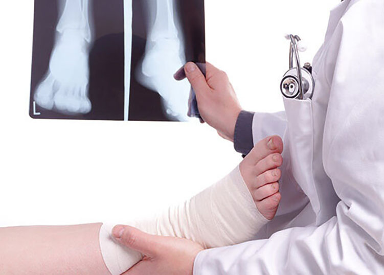 Doctor exam one X-ray picture of sprained foot