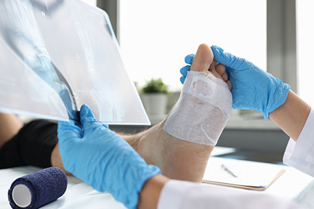 Foot Cut Urgent care for Diabetic Foot Wound Treatment | Foot Wound Care