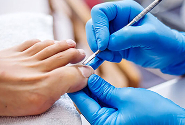 img_ingrown_toenails