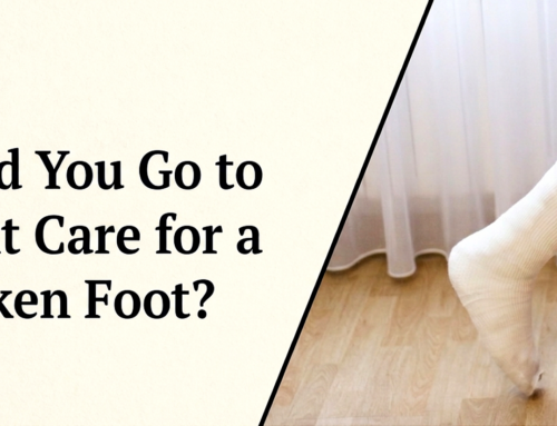 Should You Go to Urgent Care for a Broken Foot?
